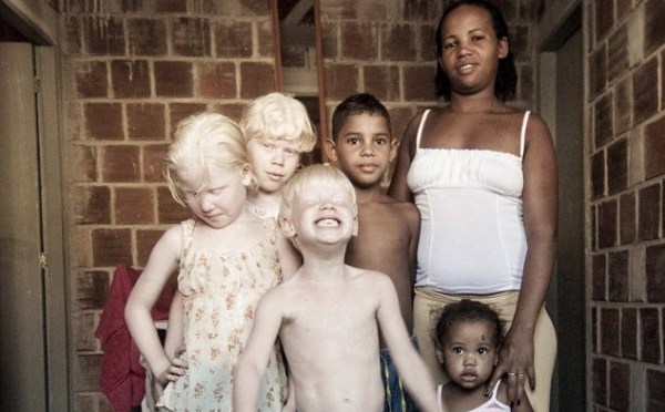 Το μυστήριο με τη μαύρη μητέρα στη Βραζιλία που γεννάει μόνο λευκά παιδιά  Περισσότερα: Το μυστήριο με τη μαύρη μητέρα στη Βραζιλία που γεννάει μόνο λευκά παιδιά .
